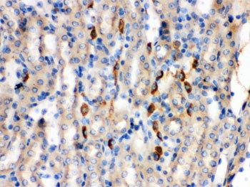 IHC testing of FFPE mouse kidney with Bradykinin antibody. HIER: Boil the paraffin secti