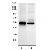 Western blot testing of 1) rat liver and 2) mouse liver lysate with SLC10A1 antibody. Expected molecular weight: 38~45 kDa.