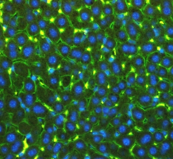 Immunofluorescent staining of FFPE mouse liver with NTCP antibody (green) and DAPI nuclear counterstain (blue). HIER: boil tissue sections in pH6, 10mM citrate buffer, for 10-20 min followed by cooling at RT for 20 min.