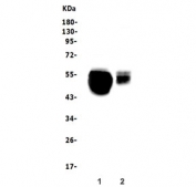 Western blot testing of 1) rat liver and 2) mouse liver lysate with SLC10A1 antibody. Expected molecular weight: 38~45 kDa.