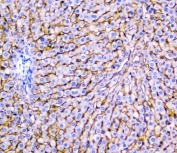 IHC testing of FFPE rat liver with NTCP antibody. HIER: Boil the paraffin sections in pH8 EDTA buffer for 20 minutes and allow to cool prior to staining.