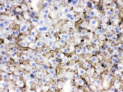 IHC testing of frozen mouse liver tissue with NTCP antibody.