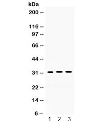 Western blot testing of mouse 1) lung, 2) kidney, 3) heart lysate with SOD3 antibody. Expected/observed molecular weight: 26~32 kDa.~