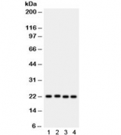 Western blot testing of 1) rat PC12, human 2) SW620, 3) HeLa and 4) MCF7 lysate with SOCS2 antibody. Expected/observed molecular weight: 22 kDa.