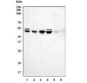 Western blot testing of 1) human HeLa, 2) monkey COS-7, 3) human Jurkat, 4) human Raji, 5) rat testis and 6) mouse testis tissue lysate with MKK7 antibody. Predicted molecular weight ~47 kDa.