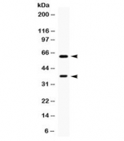 Western blot testing of human HeLa cell lysate with TPP1 antibody. Expected molecular weight: 61/34 kDa (isoforms 1/2).