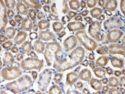IHC testing of FFPE mouse kidney with AIM2 antibody. HIER: Boil the paraffin sections in pH 6, 10mM citrate buffer for 20 minutes and allow to cool prior to staining.