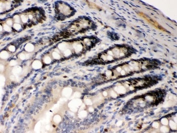 IHC testing of FFPE rat intestine with AIM2 antibody. HIER: Boil the paraffin sections in pH 6, 10mM citrate buffer for 20 minutes and allow to cool prior to staining.