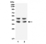 Western blot testing of 1) human Raji and 2) mouse NIH3T3 cell lysate with AIM2 antibody. Expected molecular weight: 40-45 kDa.