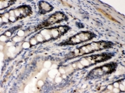 IHC testing of FFPE rat intestine with AIM2 antibody. HIER: Boil the paraffin sections in pH 6, 10mM citrate buffer for 20 minutes and allow to cool prior to staining.