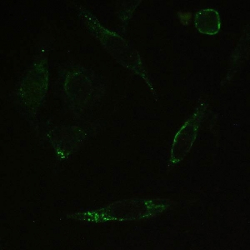 IHC testing of FFPE human SiHa cells with PPP1R12A antibody. HIER: Boil the paraffin sections in pH 6, 10mM citrate buffer for 20 minutes and allow to cool prior to staining.