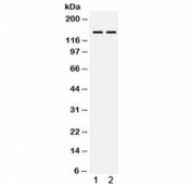 Western blot testing of 1) mouse skeletal muscle and 2) human HeLa lysate with PPP1R12A antibody. Expected molecular weight: 110~130 kDa, observed here at ~150 kDa.