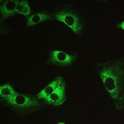 IHC testing of FFPE human U-251 MG cells with PPP1R12A antibody. HIER: Boil the paraffin sections in pH 6, 10mM citrate buffer for 20 minutes and allow to cool prior to staining.