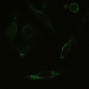 IHC testing of FFPE human SiHa cells with PPP1R12A antibody. HIER: Boil the paraffin sections in pH 6, 10mM citrate buffer for 20 minutes and allow to cool prior to staining.
