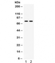 Western blot testing of 1) mouse testis and 2) human 22RV1 lysate with MDM4 antibody. Predicted molecular weight ~55 kDa but routinely observed at ~80 kDa.