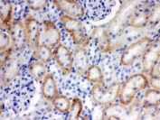 IHC testing of FFPE rat kidney with SLC22A2 antibody. HIER: Boil the paraffin sections in pH 6, 10mM citrate buffer for 20 minutes and allow to cool prior to staining.