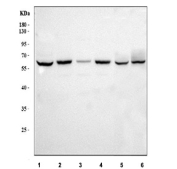Western blot testing of 1) human 293T, 2) human U-87 MG, 3) human OS-RC2, 4) monkey COS7, 5) rat liver and 6) mouse liver tissue lysate with SLC22A2 antibody. Expected molecular weight: 55-100 kDa depending on glycosylation level.