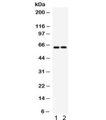 Western blot testing of 1) rat brain and 2) mouse brain lysate with SLC22A2 antibody. Expected/observed molecular weight 63 kDa.