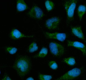 Immunofluorescent staining of FFPE human HeLa cells with SLC22A2 antibody (green) and DAPI nuclear stain (blue). HIER: steam section in pH6 citrate buffer for 20 min.