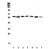 Western blot testing of human 1) placenta, 2) U-87 MG, 3) A431, 4) PC-3, 5) U-2 OS, 6) HepG2 and 7) U-937 cell lysate with SPTLC1 antibody. Expected molecular weight ~53 kDa.