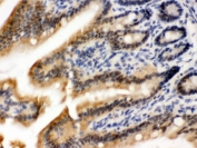 IHC testing of FFPE mouse intestine with OGT antibody. HIER: Boil the paraffin sections in pH 6, 10mM citrate buffer for 20 minutes and allow to cool prior to staining.