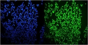Immunofluorescent staining of FFPE human A431 cells with OGT antibody (green) and DAPI nuclear stain (blue). HIER: steam section in pH6 citrate buffer for 20 min.