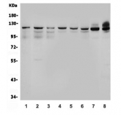 Western blot testing of human 1) HeLa, 2) PC-3, 3) A431, 4) A549, 5) Caco-2, 6) K562, 7) rat heart and 8) mouse heart lysate with OGT antibody. Expected molecular weight 110-117 kDa.