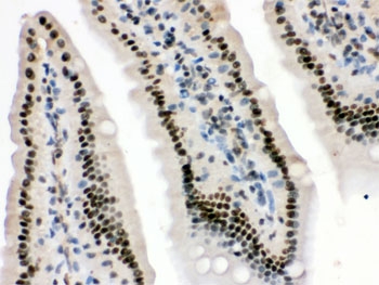 IHC testing of FFPE mouse intestine with HMG4 antibody. HIER: Boil the paraffin sections in pH 6, 10mM citrate buffer for 20 minutes and allow to cool prior to staining.