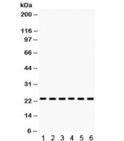 Western blot testing of 1) mouse liver, 2) mouse kidney, 3) mouse testis, 4) human 22RV1, 5) human MCF7 and 6) mouse NIH3T3 lysate with HMG4 antibody. Expected/observed molecular weight ~23 kDa.