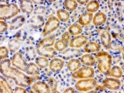 IHC testing of FFPE rat kidney with CYP27B1 antibody. HIER: Boil the paraffin sections in pH 6, 10mM citrate buffer for 20 minutes and allow to cool prior to staining.