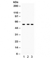 Western blot testing of 1) rat kidney, 2) mouse kidney and 3) 293 lysate with CYP27B1 antibody. Predicted/observed molecular weight ~57 kDa.