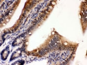 IHC testing of FFPE mouse intestine with PDPK1 antibody. HIER: Boil the paraffin sections in pH 6, 10mM citrate buffer for 20 minutes and allow to cool prior to staining.