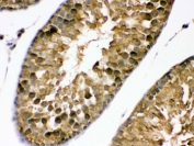 IHC testing of FFPE rat testis with PDPK1 antibody. HIER: Boil the paraffin sections in pH 6, 10mM citrate buffer for 20 minutes and allow to cool prior to staining.