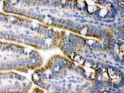 IHC testing of frozen mouse small intestine tissue with PDPK1 antibody.