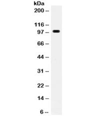 Western blot testing of mouse Hepa1-6 cell lysate with RANK antibody. Predicted molecular weight ~66 kDa, routinely observed at 80~100 kDa.
