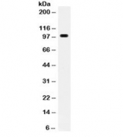 Western blot testing of mouse Hepa1-6 cell lysate with RANK antibody. Predicted molecular weight ~66 kDa, routinely observed at 80~100 kDa.