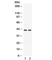 Western blot testing of human 1) A549 and 2) COLO320 cell lysate with RAD51C antibody. Expected molecular weight ~42 kDa.