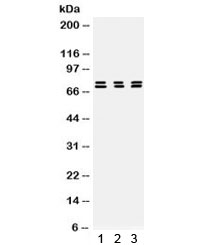 Western blot testing of human 1) MCF7, 2) SGC and 3) HeLa cell lysate with PRC1 antibody. Expected molecular weight ~70-80 kDa doublet.