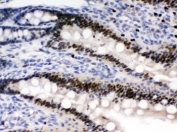 IHC testing of FFPE rat intestine with PRKAB2 antibody. HIER: Boil the paraffin sections in pH 6, 10mM citrate buffer for 20 minutes and allow to cool prior to staining.