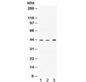 Western blot testing of 1) rat heart, 2) human HepG2 and 3) human A549 lysate with VEGFD antibody. Expected molecular weight: 40-53 kDa (pro-form), ~21 kDa (mature/active form).