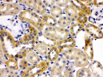 IHC testing of FFPE rat kidney with OPA1 antibody. HIER: Boil the paraffin sections in pH 6, 10mM citrate buffer for 20 minutes and allow to cool prior to staining.