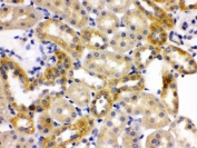 IHC testing of FFPE rat kidney with OPA1 antibody. HIER: Boil the paraffin sections in pH 6, 10mM citrate buffer for 20 minutes and allow to cool prior to staining.