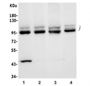 Western blot testing of human 1) MCF7, 2) PANC-1, 3) PC-3 and 4) T-47D lysate with OPA1 antibody. Predicted molecular weight: 111-120 kDa with multiple smaller isoforms from 81-95 kDa.