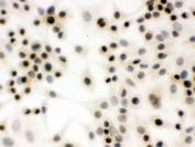 ICC testing of FFPE human A549 cells with p95 NBS1 antibody. HIER: Boil the paraffin sections in pH 6, 10mM citrate buffer for 20 minutes and allow to cool prior to staining.