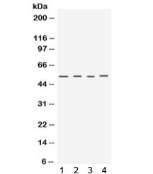 Western blot testing of 1) mouse testis, 2) mouse skeletal muscle, 3) human MCF7 and 4) human A549 lysate with Keratocan antibody. Predicted molecular weight ~40 kDa but the mature protein can be observed ~52 kDa with possible 34/37 kDa breakdown products. (Ref 1)