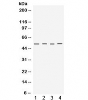 Western blot testing of 1) mouse testis, 2) mouse skeletal muscle, 3) human MCF7 and 4) human A549 lysate with Keratocan antibody. Predicted molecular weight ~40 kDa but the mature protein can be observed ~52 kDa with possible 34/37 kDa breakdown products. (Ref 1)