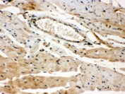 IHC testing of FFPE mouse heart with ROCK2 antibody. HIER: Boil the paraffin sections in pH 6, 10mM citrate buffer for 20 minutes and allow to cool prior to staining.