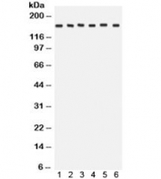 Western blot testing of 1) rat brain, 2) rat liver, 3) human HeLa, 4) CEM, 5) A549 and 6) MCF7 lysate with ROCK2 antibody.  Expected/observed molecular weight: ~161 kDa.
