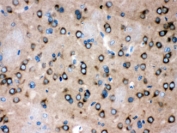 IHC testing of FFPE rat brain with ROCK2 antibody. HIER: Boil the paraffin sections in pH 6, 10mM citrate buffer for 20 minutes and allow to cool prior to staining.