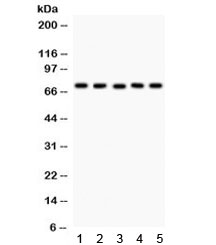 Western blot testing of 1) rat heart, 2) rat kidney, 3) rat liver, 4) rat lung, and 5) human SKOV lysate with EED antibody. Multiple isoforms can be observed from 30~65 kDa.